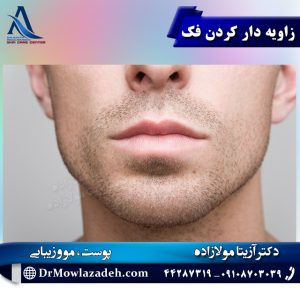 زاویه دار کردن فک