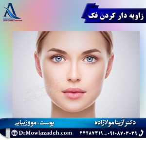 زاویه دار کردن فک