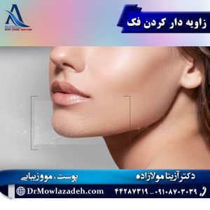 زاویه دار کردن فک