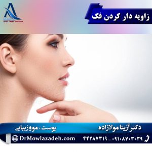 زاویه دار کردن فک