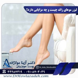لیزر-موهای-زائد-چیست