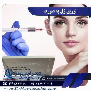 آنچه در مورد تزریق ژل به صورت نمیدانید