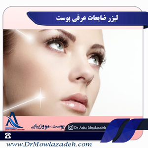 لیزر ضایعات عروقی پوست