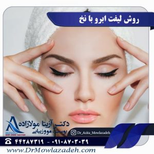 روش لیفت ابرو با نخ