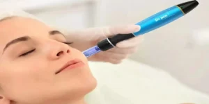 مزایا میکرونیدلینگ برای پوست