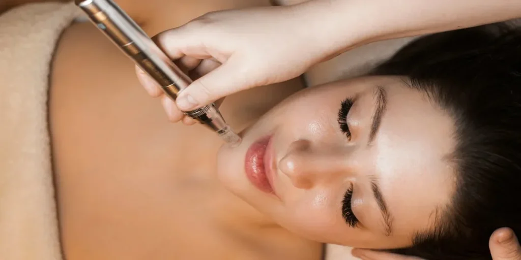 میکرونیدلینگ برای جوش سر سیاه