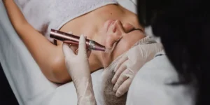 میکرونیدلینگ را هر چند وقت یکبار باید انجام داد