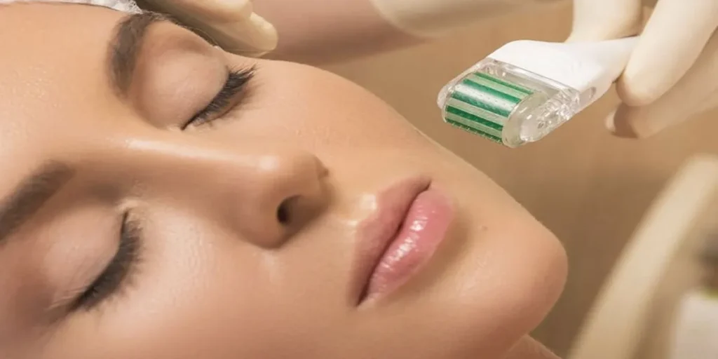 فواید میکرونیدلینگ برای جای جوش