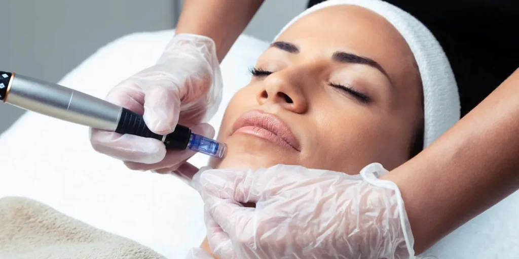 تفاوت درماپن و میکرونیدلینگ؛ کدام روش برای جوانسازی پوست بهتر است؟
جذاب‌ترین راه برای جوانسازی پوست همیشه آن روشی است که هم ایمن باشد و هم نتیجه‌اش سریع‌تر دیده شود. وقتی صحبت از تفاوت درماپن و میکرونیدلینگ می‌شود، بسیاری از افراد دچار تردید می‌شوند که کدام انتخاب بهتر است. درماپن با استفاده از سوزن‌های ریز و حرکت عمودی، کانال‌های دقیق‌تری روی پوست ایجاد می‌کند و به همین دلیل امروزه در کلینیک‌های تخصصی بیشتر توصیه می‌شود. از سوی دیگر، میکرونیدلینگ سنتی با رولر انجام می‌شود که اگرچه سال‌ها مورد استفاده بوده، اما دقت و کنترل درماپن را ندارد.
این دو روش در کاهش چین‌وچروک، بهبود جای جوش و افزایش کلاژن‌سازی شباهت‌هایی دارند اما تفاوت‌های علمی و عملی آن‌ها می‌تواند مسیر انتخاب شما را تغییر دهد. اگر به دنبال روشی مطمئن برای بازگرداندن طراوت پوست هستید، شناخت دقیق این تفاوت‌ها ضروری است. در ادامه با ما همراه باشید تا با یک نگاه علمی و کاربردی، بهترین تصمیم را بگیرید.
درماپن و میکرونیدلینگ؛ تعریف علمی و کاربردی هر روش
برای شروع بحث باید بدانیم که هر دو روش بر پایه اصل «ایجاد میکروکانال‌های کنترل‌شده در پوست» عمل می‌کنند. این کانال‌های ریز باعث تحریک فیبروبلاست‌ها و افزایش کلاژن‌سازی می‌شوند. میکرونیدلینگ سنتی معمولاً با رولر انجام می‌شود؛ دستگاهی غلتکی با سوزن‌های ریز که روی پوست کشیده می‌شود. در مقابل، درماپن دستگاهی قلمی‌شکل با سوزن‌های نوسانی است که به‌صورت عمودی وارد پوست می‌شوند. کاربردهای اصلی این دو روش شامل:
کاهش چین‌وچروک‌های سطحی
درمان جای جوش و اسکار
بهبود لکه‌های پوستی و شفافیت پوست
کمک به جذب بهتر سرم‌ها و داروهای موضعی
بسیاری از بیماران هنگام انتخاب روش، به سراغ متخصصان مجرب می‌روند. اگر شما هم در تهران به دنبال این خدمات هستید، مشاوره با بهترین دکتر پوست در غرب تهران می‌تواند به شما کمک کند تا مناسب‌ترین روش برای شرایط پوستتان را انتخاب کنید.
تفاوت تکنولوژی؛ چرا درماپن دقیق‌تر از میکرونیدلینگ سنتی است؟
بر اساس مطالعات اخیر (PubMed 2023)، تفاوت اصلی در نوع حرکت سوزن‌هاست. در میکرونیدلینگ سنتی، سوزن‌ها با حرکت غلتکی روی پوست کشیده می‌شوند که گاهی باعث آسیب‌های نامنظم می‌شود. در مقابل، درماپن از حرکت عمودی و قابل‌کنترل استفاده می‌کند.
مقایسه تکنولوژی:
ویژگی
میکرونیدلینگ سنتی
درماپن
نوع حرکت
غلتکی (افقی)
عمودی و نوسانی
دقت کار
کمتر
بسیار بالا
کنترل عمق
محدود
قابل تنظیم
یکنواختی سوراخ‌ها
نامنظم
یکنواخت

نتیجه اینکه درماپن امکان تنظیم عمق سوزن را برای نواحی مختلف (مثلاً دور چشم یا گونه‌ها) فراهم می‌کند. همین موضوع باعث شده بسیاری از دکتر پوست و مو و زیبایی در کلینیک‌ها به‌جای روش سنتی، درماپن را ترجیح دهند.
اثرات بالینی روی پوست؛ کدام روش نتایج بهتر دارد؟
تحقیقات بالینی نشان داده‌اند که هر دو روش باعث افزایش تولید کلاژن و الاستین می‌شوند، اما کیفیت نتایج در درماپن معمولاً بالاتر است. در مطالعه‌ای که در Journal of Cosmetic Dermatology منتشر شد، بیماران تحت درمان با درماپن بهبود بیشتری در کاهش اسکار آکنه و چین‌وچروک داشتند.
تفاوت در نتایج:
درماپن → نتایج سریع‌تر، یکنواخت‌تر، مناسب برای جای جوش‌های عمیق
میکرونیدلینگ سنتی → بهبود نسبی، مناسب برای آسیب‌های سطحی‌تر
هر دو روش → نیاز به چند جلسه (۳ تا ۶ جلسه) برای نتیجه پایدار
با این حال، نتیجه نهایی وابسته به شرایط فردی مثل نوع پوست، سن و سبک زندگی است. بسیاری از بیماران در جلسات مشاوره، علاوه بر اثربخشی، به فاکتور هزینه میکرونیدلینگ هم توجه دارند. هزینه‌ها بر اساس نوع دستگاه، تعداد جلسات و تجربه پزشک متفاوت است.
میزان درد، عوارض و دوره نقاهت؛ تجربه واقعی بیماران
از دیدگاه بیماران، مهم‌ترین پرسش این است که «آیا این روش دردناک است؟». واقعیت این است که هر دو روش با درد خفیف تا متوسط همراه هستند که معمولاً با کرم‌های بی‌حسی موضعی کنترل می‌شوند.
درماپن: درد کمتر به دلیل ورود عمودی و سریع سوزن‌ها
میکرونیدلینگ سنتی: احتمال درد بیشتر به دلیل کشیده شدن سوزن‌ها روی پوست
عوارض شایع و موقت:
قرمزی و التهاب خفیف (۲۴ تا ۷۲ ساعت)
خشکی یا پوسته‌ریزی جزئی
حساسیت به نور خورشید
دوره نقاهت معمولاً کوتاه است و بیماران بعد از ۲ تا ۳ روز می‌توانند به فعالیت‌های روزانه بازگردند. بر اساس تجربه کلینیک‌های معتبر، انتخاب دستگاه اهمیت زیادی دارد. استفاده از بهترین دستگاه میکرونیدلینگ می‌تواند عوارض را به حداقل برساند و سرعت بهبود را افزایش دهد.
هزینه و دسترسی؛ کدام روش مقرون‌به‌صرفه‌تر است؟
هزینه همیشه یکی از عوامل اصلی در انتخاب بین درماپن و میکرونیدلینگ است. بر اساس بررسی‌های کلینیک‌های پوست در ایران و مقالات بین‌المللی (Journal of Aesthetic Medicine، ۲۰۲۲)، قیمت این دو روش به عوامل زیر بستگی دارد:
نوع دستگاه مورد استفاده (جدیدترین مدل‌ها هزینه بیشتری دارند)
تعداد جلسات مورد نیاز (۳ تا ۶ جلسه برای نتیجه پایدار)
تجربه پزشک و موقعیت جغرافیایی کلینیک
ترکیب درمان با سایر روش‌ها مثل PRP یا سرم‌های ویتامینی
مقایسه تقریبی:
روش
میانگین هزینه در هر جلسه (ایران)
تعداد جلسات
هزینه کلی
میکرونیدلینگ سنتی
کمتر
۳–۵ جلسه
مقرون‌به‌صرفه‌تر
درماپن
بالاتر
۳–۴ جلسه
اثربخشی سریع‌تر و پایدارتر

نتیجه: میکرونیدلینگ سنتی در نگاه اول اقتصادی‌تر است، اما اگر کیفیت و دوام نتایج را در نظر بگیریم، درماپن در بلندمدت می‌تواند ارزش بیشتری داشته باشد. 
چه کسانی کاندید مناسب درماپن هستند و چه کسانی میکرونیدلینگ؟
انتخاب بین این دو روش به شرایط پوستی فرد بستگی دارد. متخصصان پوست معمولاً بر اساس سن، نوع پوست و شدت مشکلات پوستی تصمیم می‌گیرند.
کاندید مناسب درماپن:
افراد با اسکار آکنه عمیق
کسانی که به دنبال نتایج سریع‌تر هستند
افرادی که به یکنواختی درمان اهمیت می‌دهند
افراد با پوست حساس که نیاز به کنترل دقیق عمق سوزن دارند
کاندید مناسب میکرونیدلینگ سنتی:
کسانی که مشکلات سطحی‌تر مثل لک‌های ملایم یا خطوط ریز دارند
افراد جوان‌تر با پوست نسبتاً سالم
کسانی که به دنبال روشی اقتصادی‌تر هستند
در نهایت، مشاوره با پزشک بهترین مسیر برای تعیین روش مناسب است.
ترکیب روش‌ها با درمان‌های دیگر؛ راهکارهای نوین جوانسازی
پیشرفت‌های اخیر در حوزه زیبایی نشان داده‌اند که ترکیب درماپن یا میکرونیدلینگ با سایر درمان‌ها می‌تواند نتایج را چند برابر بهتر کند. برخی از ترکیب‌های پرکاربرد عبارتند از:
درماپن + PRP (پلاسمای غنی از پلاکت): افزایش کلاژن‌سازی و بهبود اسکارها
میکرونیدلینگ + سرم‌های ویتامینی و هیالورونیک اسید: افزایش رطوبت و شفافیت پوست
درماپن + مزوتراپی: ورود بهتر داروهای مزوتراپی به لایه‌های پوست
میکرونیدلینگ + لیزرهای ملایم: نتایج سریع‌تر در کاهش چین‌وچروک
این ترکیب‌ها در مقالات معتبر (Dermatologic Therapy, 2021) به‌عنوان رویکردهای نوین در جوانسازی پوست معرفی شده‌اند. با این حال، انتخاب روش ترکیبی باید زیر نظر متخصص و بر اساس وضعیت پوست هر فرد انجام شود.
کلام پایانی: درماپن یا میکرونیدلینگ؛ انتخابی آگاهانه برای داشتن پوستی جوان و سالم
زیبایی و جوانی پوست تنها یک آرزو نیست، بلکه با انتخاب روش مناسب می‌تواند به واقعیت تبدیل شود. وقتی درباره تفاوت درماپن و میکرونیدلینگ صحبت می‌کنیم، در واقع به دو شیوه متفاوت برای رسیدن به یک هدف اشاره داریم: تحریک پوست برای بازسازی طبیعی و افزایش کلاژن. درماپن به دلیل تکنولوژی پیشرفته، امکان تنظیم عمق نفوذ سوزن و یکنواختی بیشتر را فراهم می‌کند؛ همین موضوع باعث شده تا نتایج سریع‌تر و ایمن‌تر باشد. در مقابل، میکرونیدلینگ سنتی همچنان برای برخی افراد کاربرد دارد، اما محدودیت‌هایی مثل کنترل کمتر و احتمال تحریک بیشتر پوست دارد.
آنچه اهمیت دارد این است که هیچ روش «بهترین» مطلقی وجود ندارد؛ بلکه بهترین انتخاب بستگی به شرایط پوست، سن و هدف درمانی فرد دارد. پزشکان اغلب توصیه می‌کنند برای مشکلات عمیق‌تر پوستی، درماپن نتیجه بهتری می‌دهد، در حالی که میکرونیدلینگ می‌تواند برای بهبودهای سطحی‌تر گزینه مناسبی باشد. اگر به دنبال تصمیم درست هستید، مشاوره با متخصص پوست و بررسی نیازهای شخصی‌تان کلید اصلی است. به یاد داشته باشید، انتخاب آگاهانه می‌تواند آینده پوست شما را متحول کند.
سوالات متداول
۱. تفاوت اصلی درماپن و میکرونیدلینگ چیست؟
درماپن از سوزن‌های عمودی و قابل تنظیم استفاده می‌کند که دقت بیشتری دارند، در حالی که میکرونیدلینگ سنتی با رولر انجام می‌شود و کنترل کمتری دارد.
۲. آیا هر دو روش برای همه نوع پوست مناسب هستند؟
بله، اما نوع روش به شرایط پوستی بستگی دارد. درماپن برای پوست‌های حساس و آسیب‌دیده مناسب‌تر است.
۳. چند جلسه درمان لازم است؟
معمولاً بین ۳ تا ۶ جلسه برای هر دو روش توصیه می‌شود.
۴. هزینه کدام روش کمتر است؟
میکرونیدلینگ سنتی هزینه کمتری دارد، اما درماپن نتایج سریع‌تر و ماندگارتری ارائه می‌دهد.
۵. آیا می‌توان این روش‌ها را با درمان‌های دیگر ترکیب کرد؟
بله، ترکیب با PRP، مزوتراپی یا سرم‌های تخصصی نتایج جوانسازی را تقویت می‌کند.
۶. عوارض این روش‌ها چیست؟
عوارض موقتی شامل قرمزی، التهاب و خشکی پوست است که معمولاً طی ۲ تا ۳ روز برطرف می‌شود.
۷. بهترین انتخاب برای من کدام است؟
انتخاب باید با توجه به شرایط پوست، هدف درمانی و نظر پزشک متخصص انجام شود.
