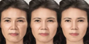 خطرات هایفو