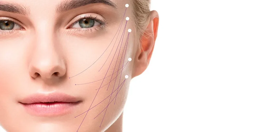 آندولیفت صورت