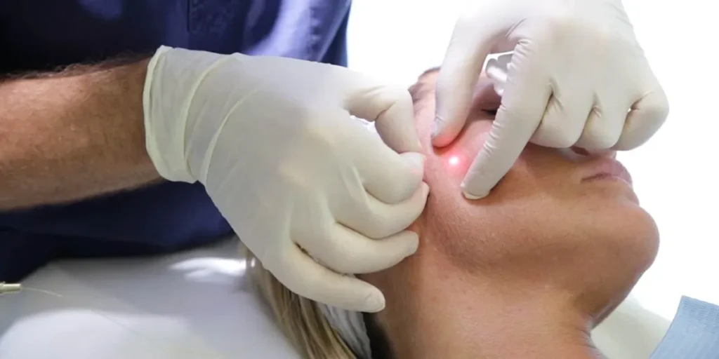 اندولیفت گردن